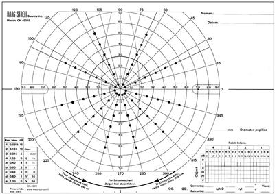 Do Impairments in Visual Functions Affect Skiing Performance?